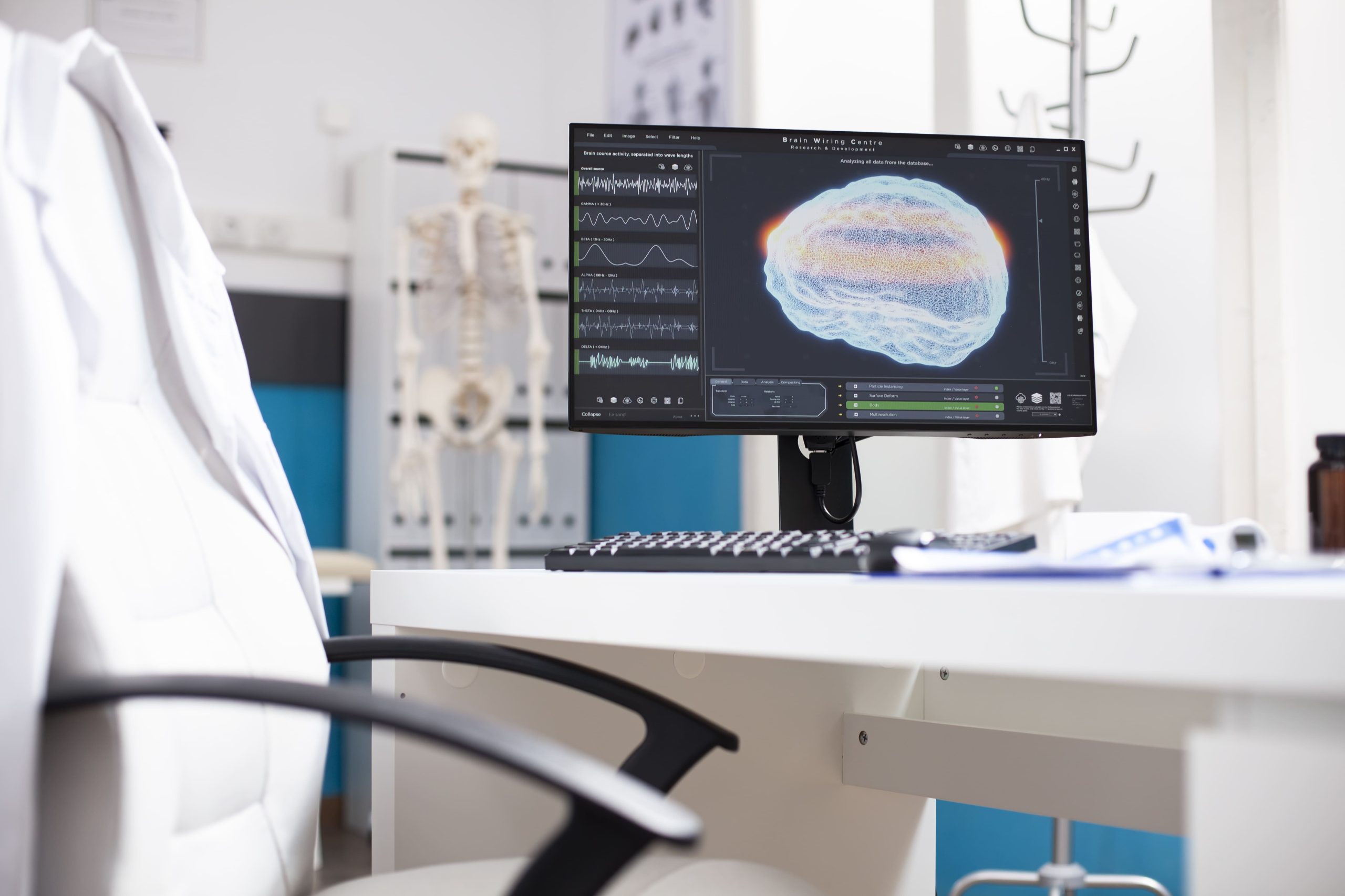 You are currently viewing Mengenal Lebih Dekat Layanan Neurology Polyclinic